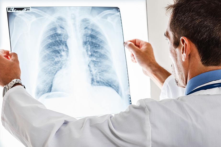 A Doctor with radiological lung x-ray film for medical diagnosis 