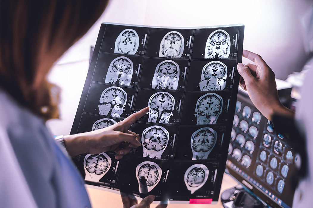 NeuroInterventional service list